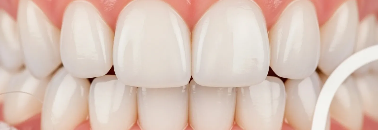 Diş Eti Hastalıkları ve Önleme Yöntemleri