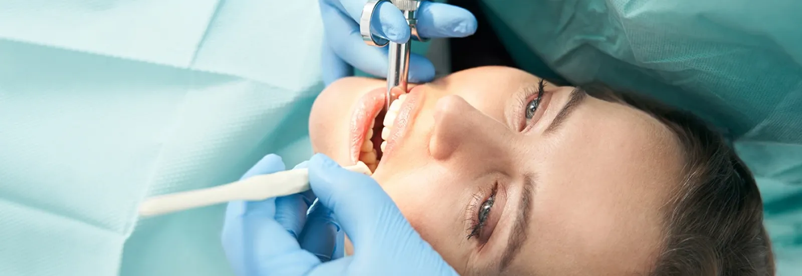 Diş Çekimi (Cerrahi)