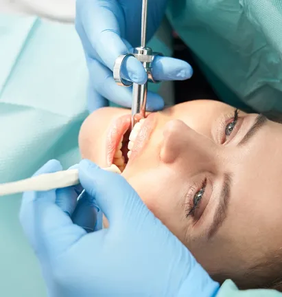 Diş Çekimi (Cerrahi)