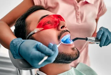 Diş Beyazlatma (Bleaching)