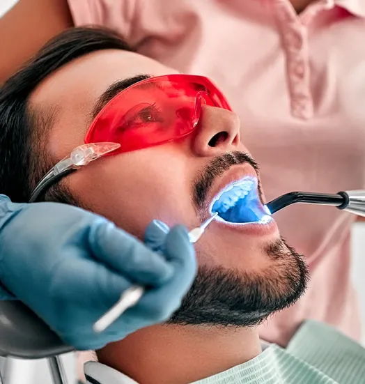 Diş Beyazlatma (Bleaching)