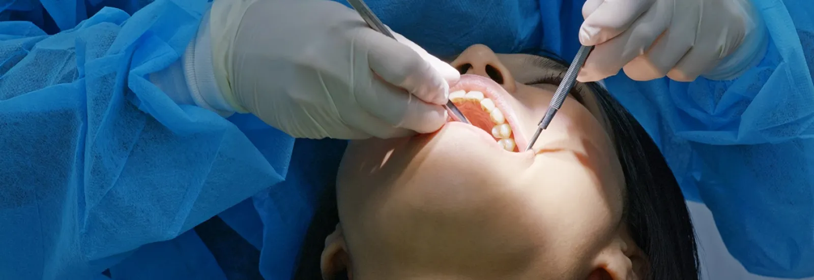 Kist Operasyonları (Cerrahi)