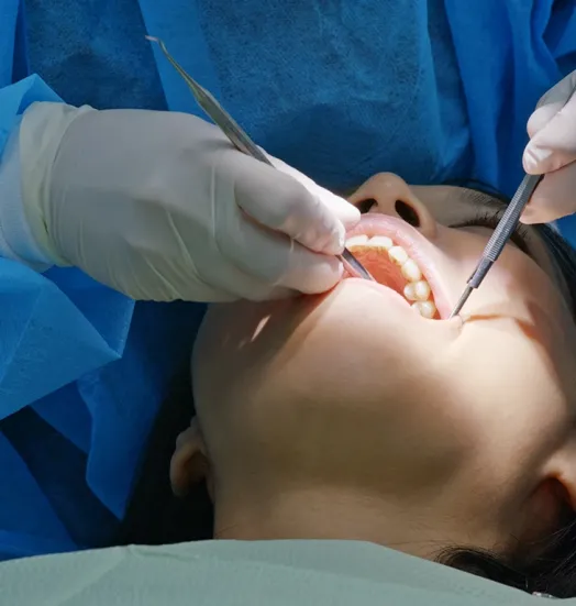 Kist Operasyonları (Cerrahi)