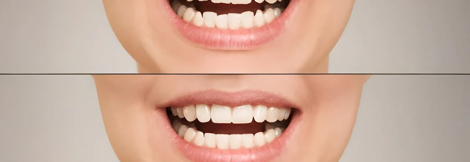 Estetik Diş Hekimliği ile Gülüşünüzü Yenileyin