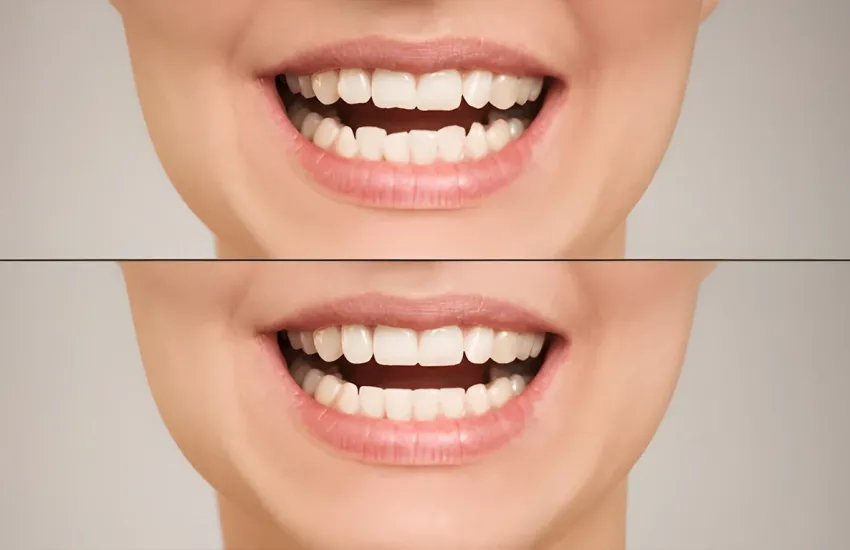 Estetik Diş Hekimliği ile Gülüşünüzü Yenileyin
